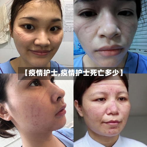 【疫情护士,疫情护士死亡多少】