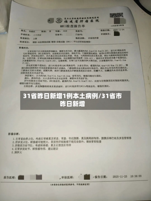 31省昨日新增1例本土病例/31省市昨日新增-第3张图片