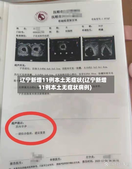 辽宁新增11例本土无症状(辽宁新增11例本土无症状病例)