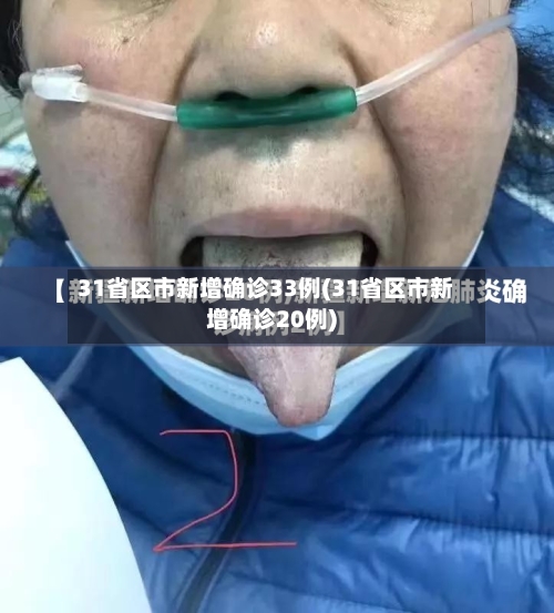 31省区市新增确诊33例(31省区市新增确诊20例)