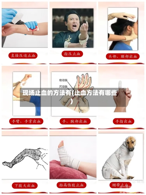 现场止血的方法有(止血方法有哪些)-第3张图片
