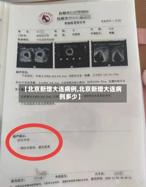 【北京新增大连病例,北京新增大连病例多少】-第1张图片