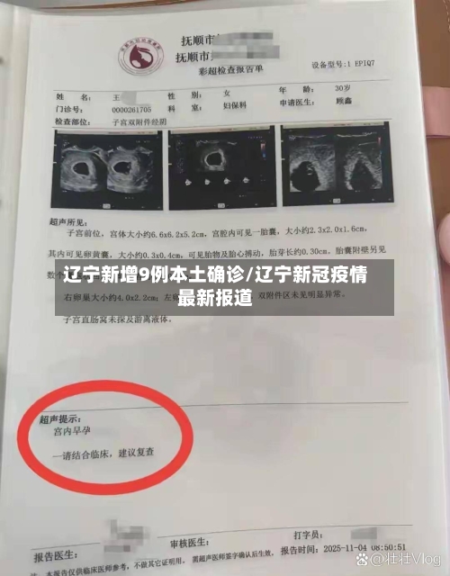 辽宁新增9例本土确诊/辽宁新冠疫情最新报道
