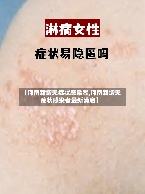 【河南新增无症状感染者,河南新增无症状感染者最新消息】-第2张图片