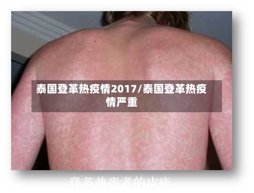 泰国登革热疫情2017/泰国登革热疫情严重