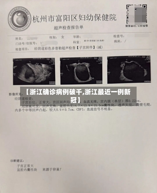 【浙江确诊病例破千,浙江最近一例新冠】-第3张图片