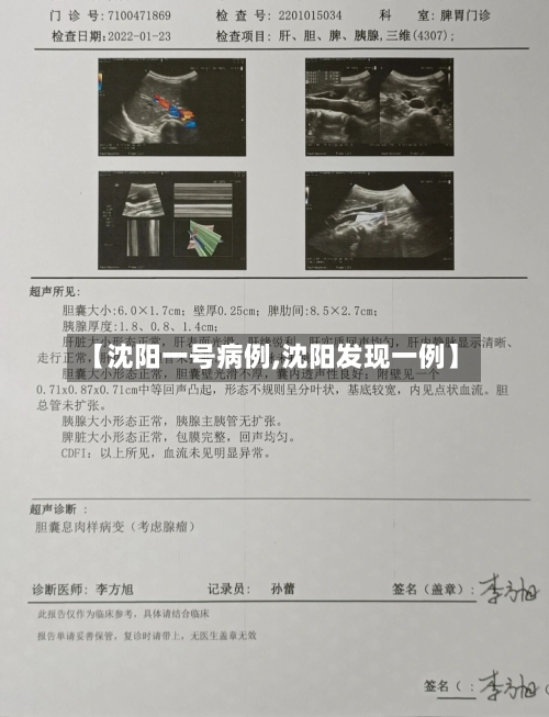 【沈阳一号病例,沈阳发现一例】-第1张图片